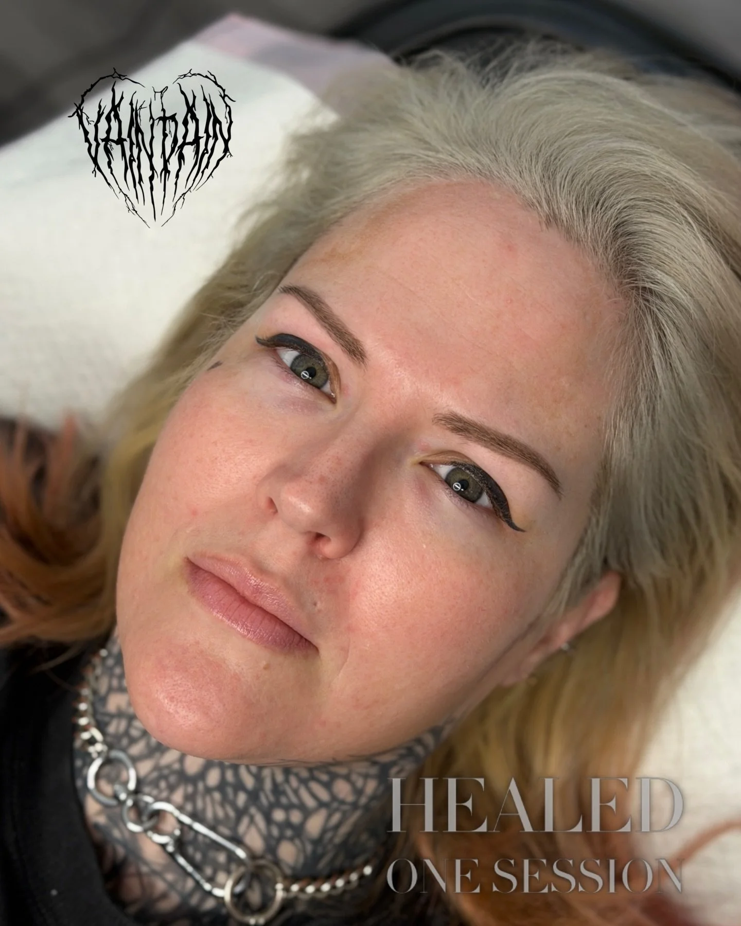 My bold clients always come thru 🖤

This client travels 3 hours from Kingaroy to come see me and 4-8 follow up was hard to organise, so we did a 6 month follow up instead. Been dying to grab at these brows again. Amazing heal in one session. Minor t