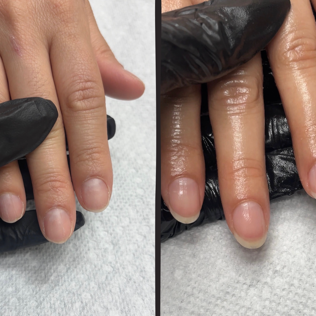 Natural nail before and after transformation