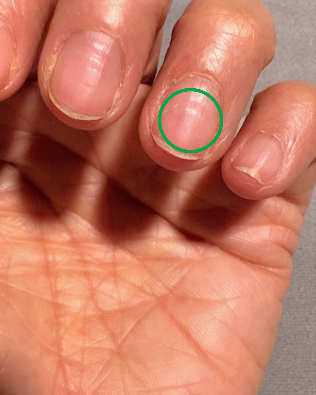How to tell if nails are damaged after gel?
