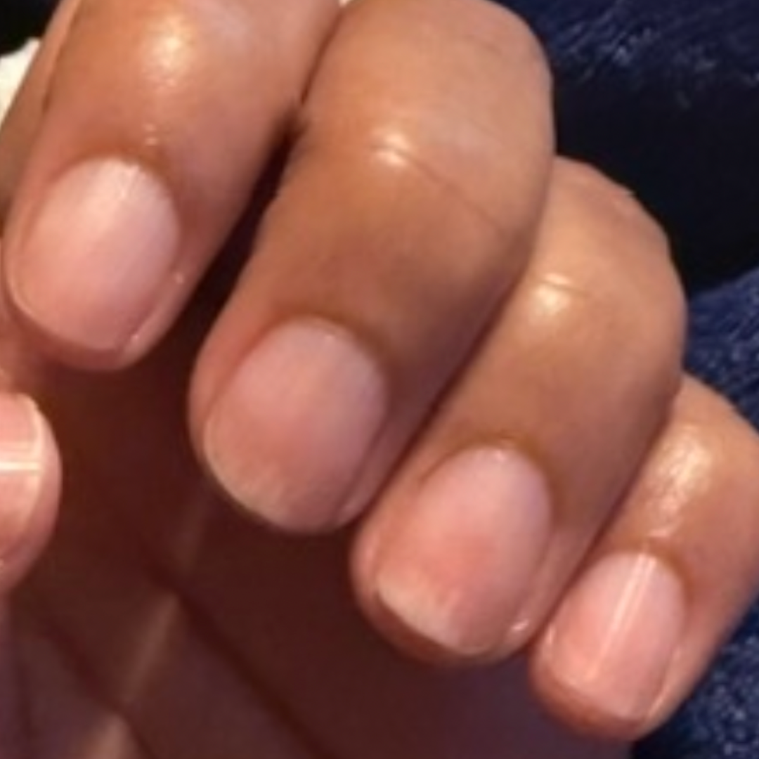 How Long Does it Take for Nails to Recover from Gel Damage?