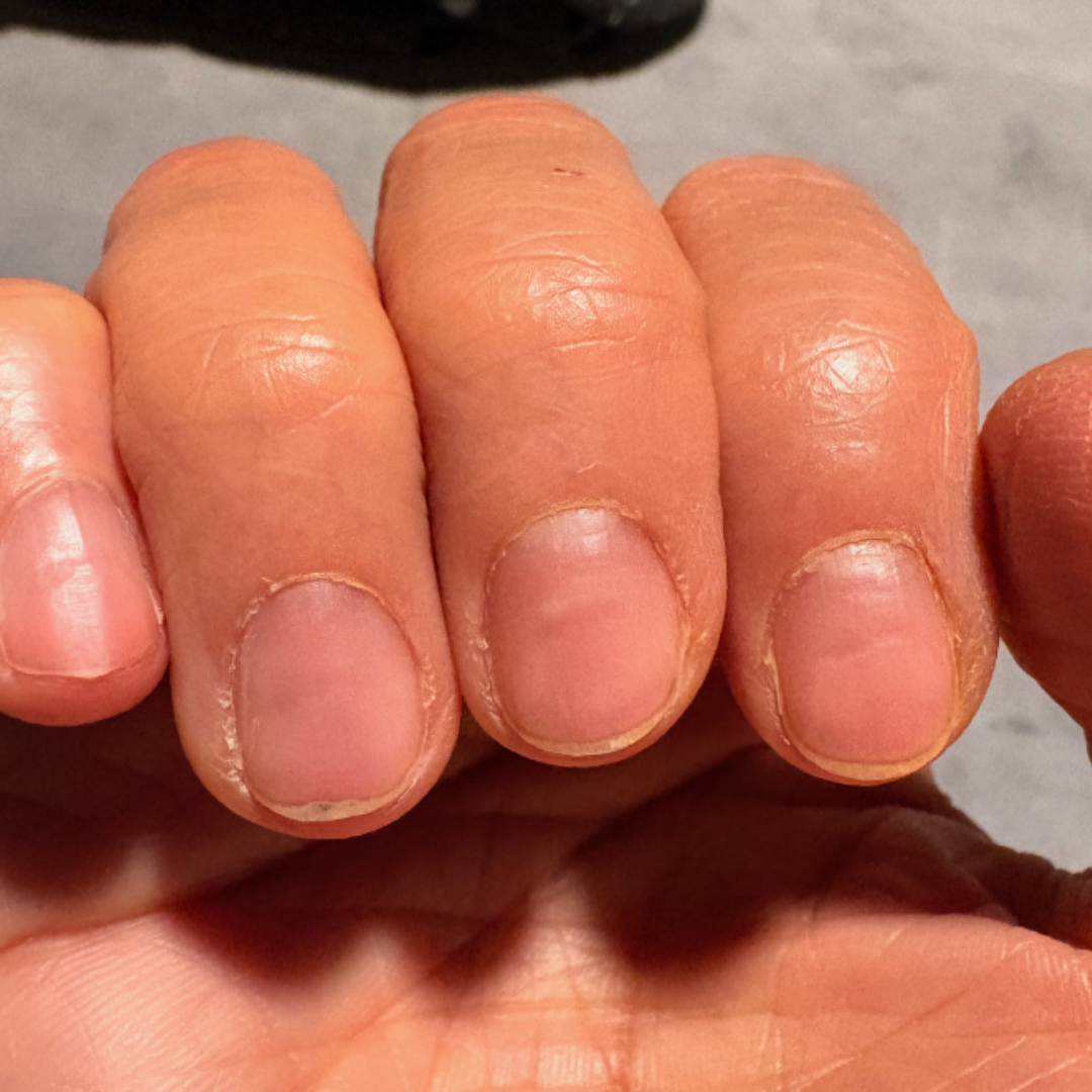 Why Are My Nails So Weak After Builder Gel?