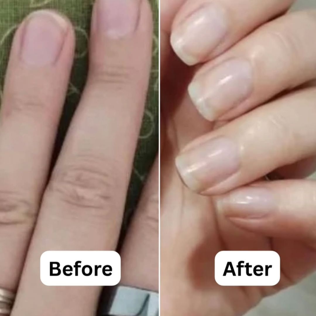 This is a before and after of a client's nails from weak and short to medium length and strong. No polish.