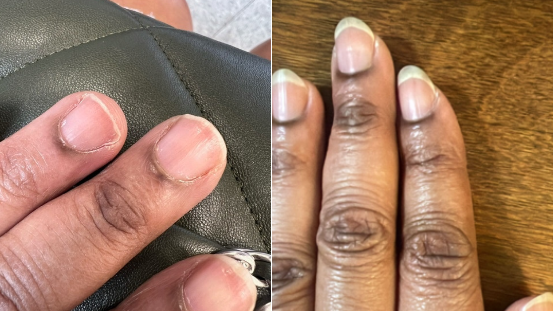 client natural nail transformation from short and brittle to strong