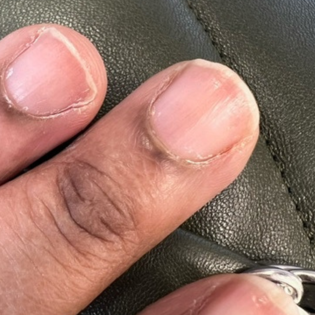 dry breaking nails in nyc