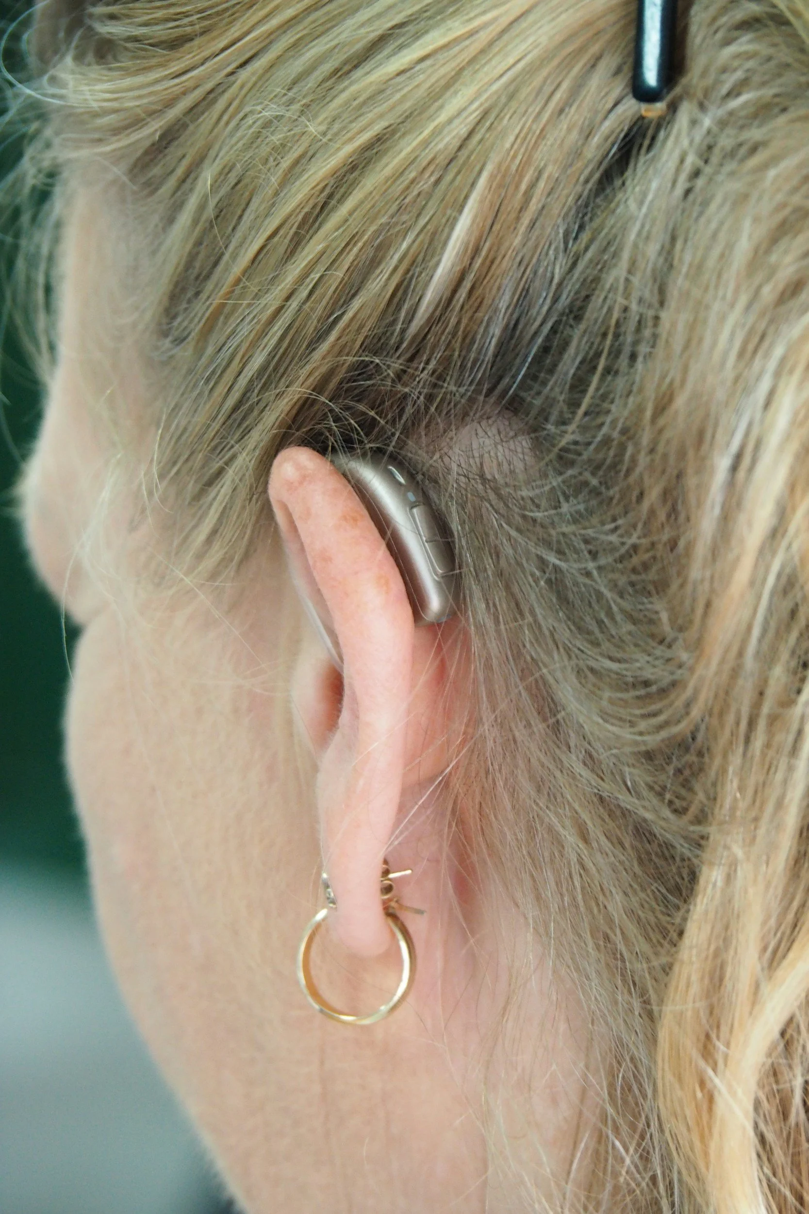 Une personne portant un appareil auditif derrière l'oreille, avec une boucle d'oreille en or, la personne a des cheveux blonds.