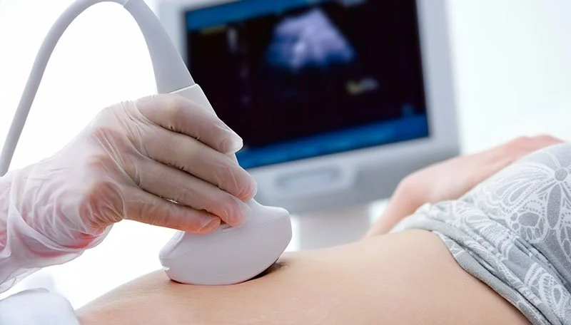 Ultrasound/Sonogram