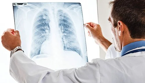X Rays Rwanda Services | Teton Radiology