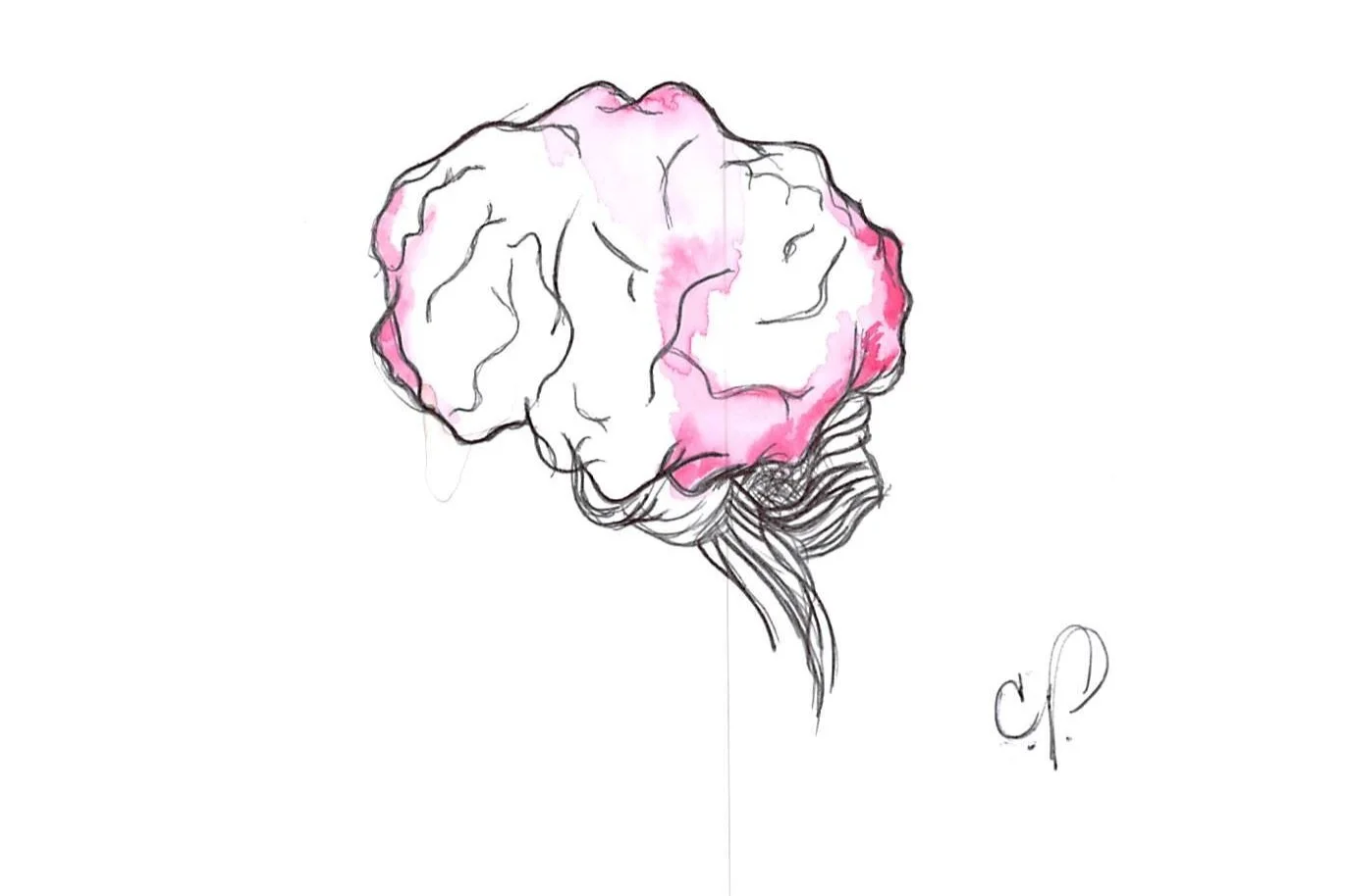 Migraine and Headache Ratings at the VA.