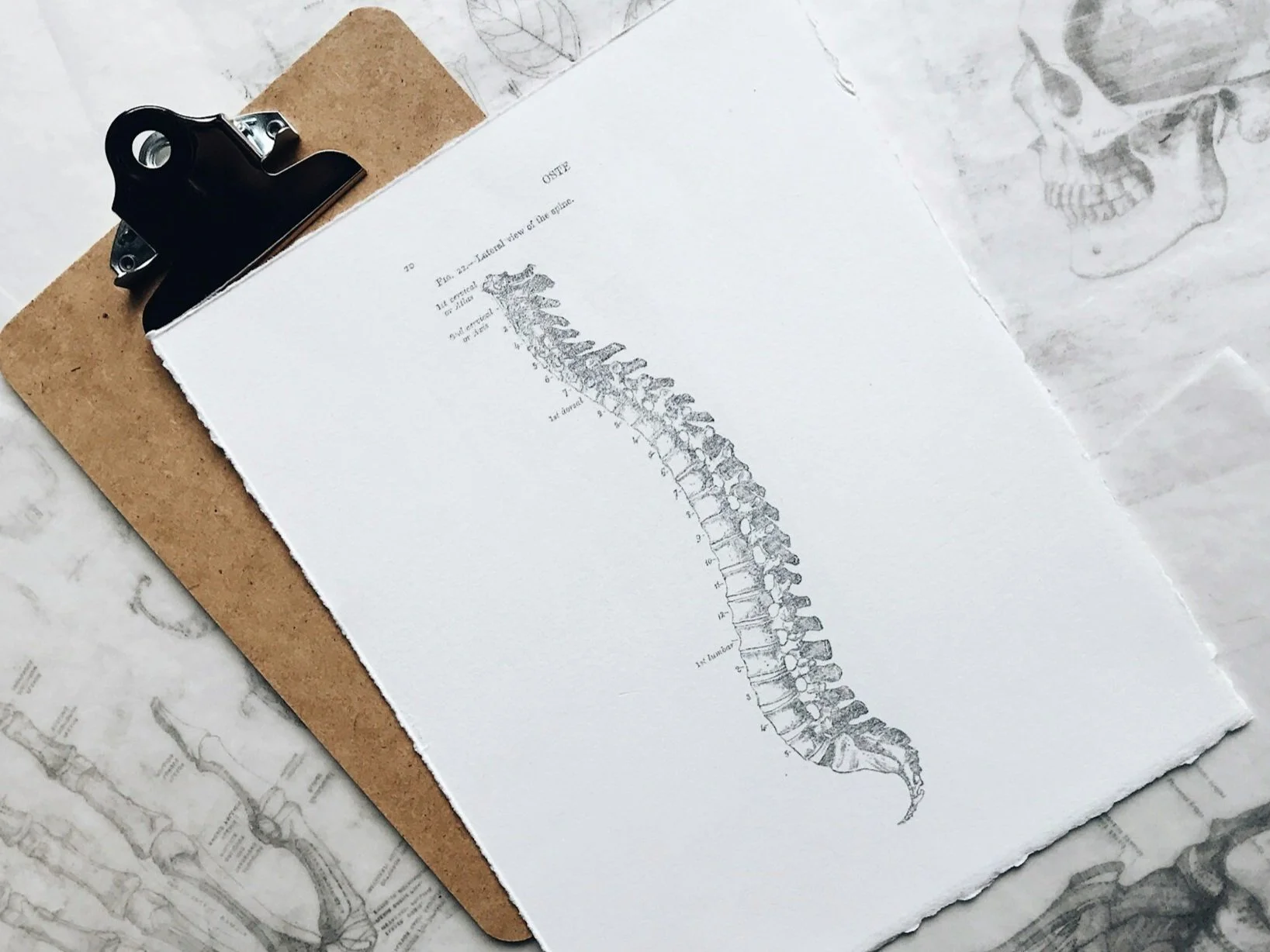 VA ratings for the Spine.