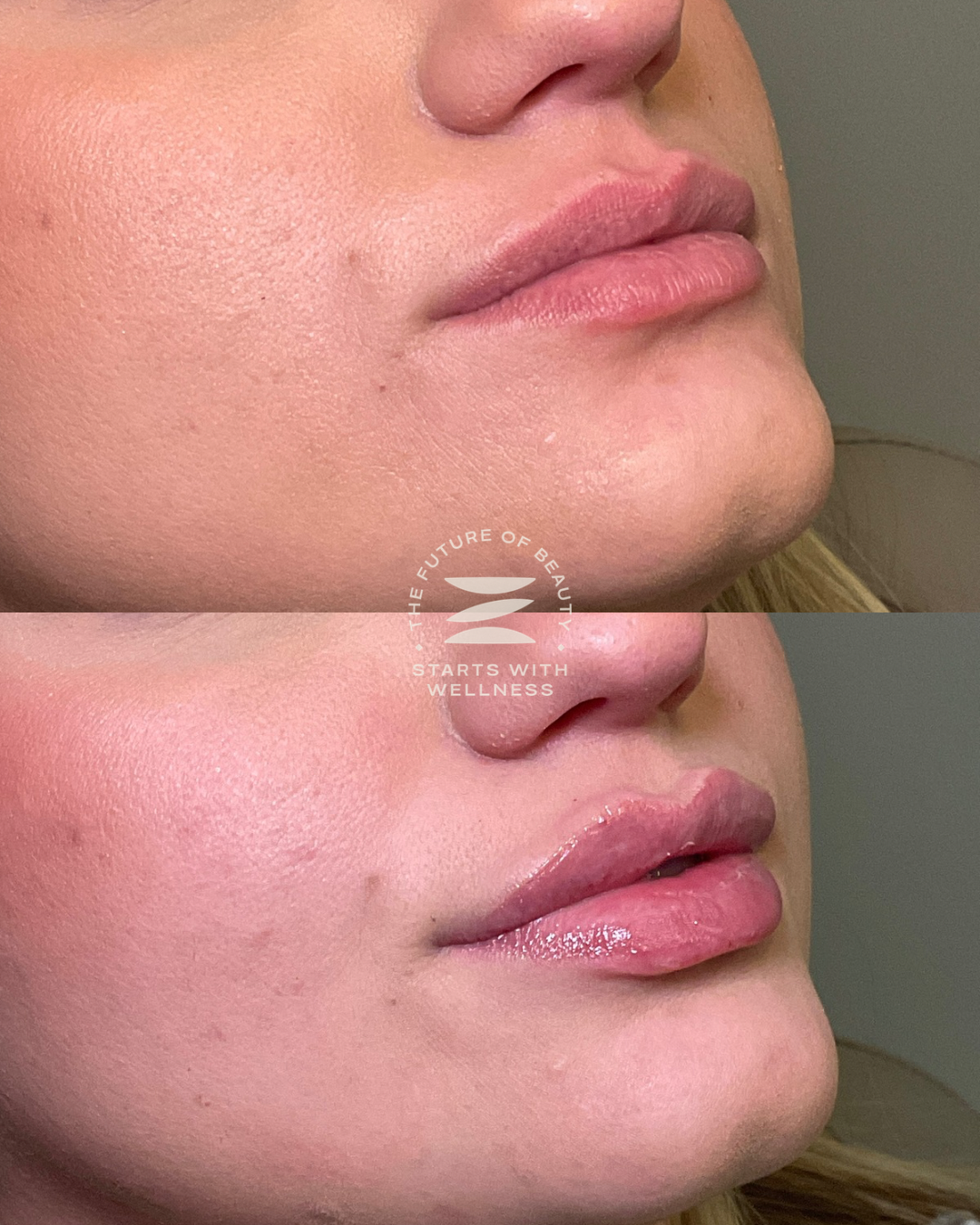 Untitled (1080 x 1350 px) - 188.PNG