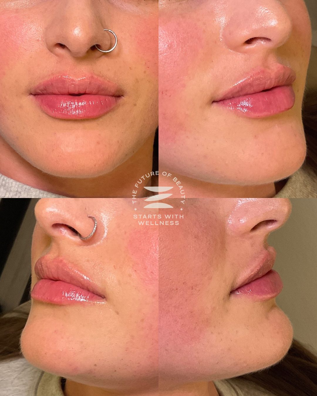 Untitled (1080 x 1350 px) - 178.PNG