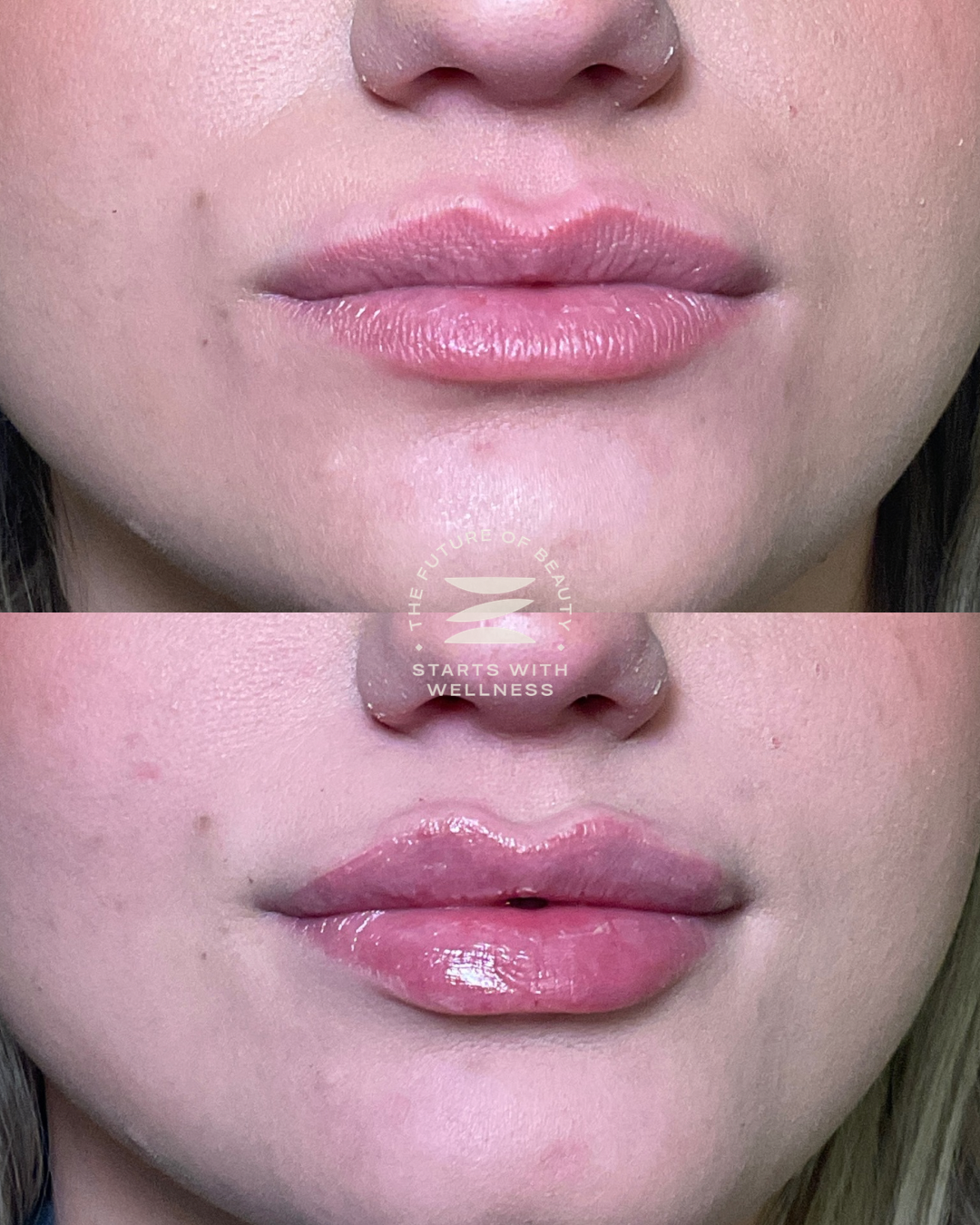 Untitled (1080 x 1350 px) - 187.PNG