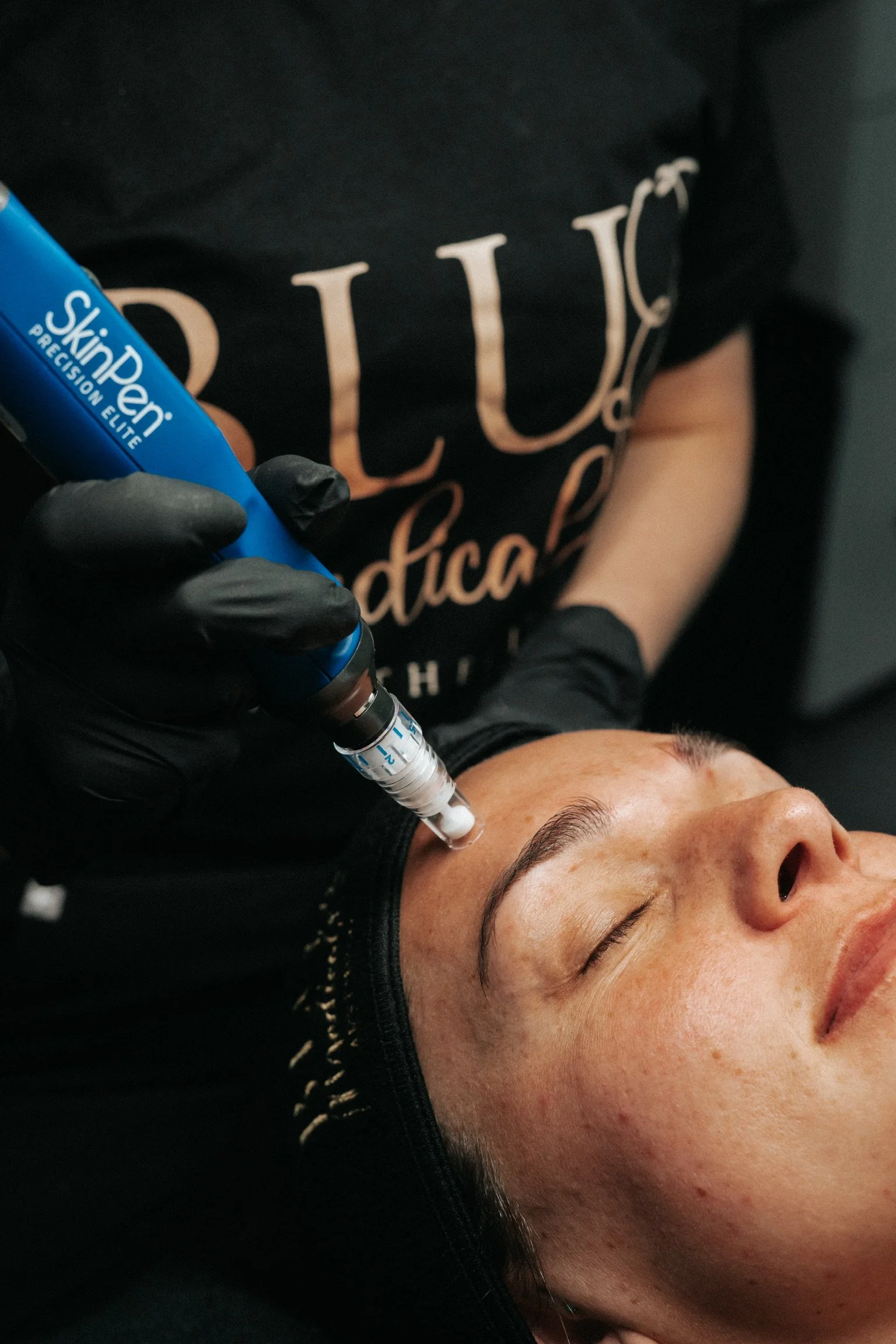 skinpen microneedling, prp microneedling centennial co