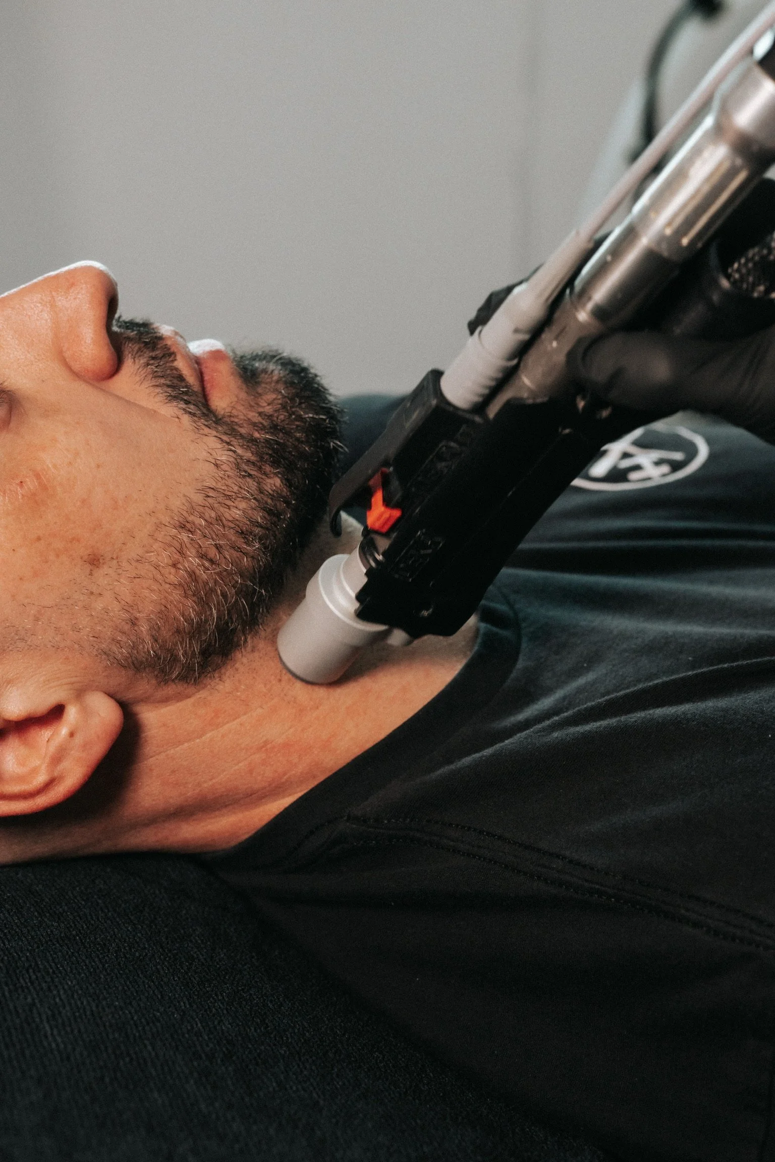 prp microneedling near me