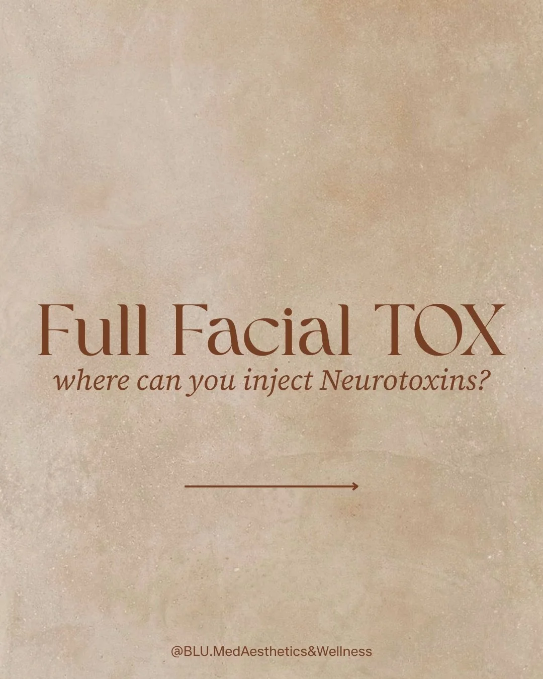 Full face tox is not about freezing your face&hellip; it&rsquo;s about balance, softening, and intentional placement 🤍

Neurotoxins like Botox can be strategically injected in multiple areas of the face and even beyond to create a more lifted, refre