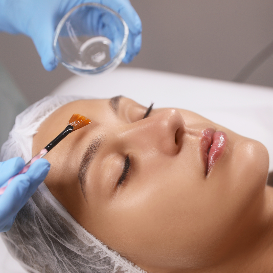 Medspa in Westlake, OH 44145 l Peels Near Me