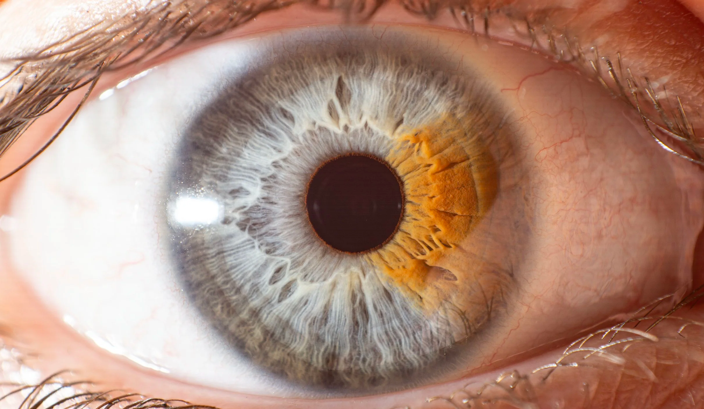 Iris Project