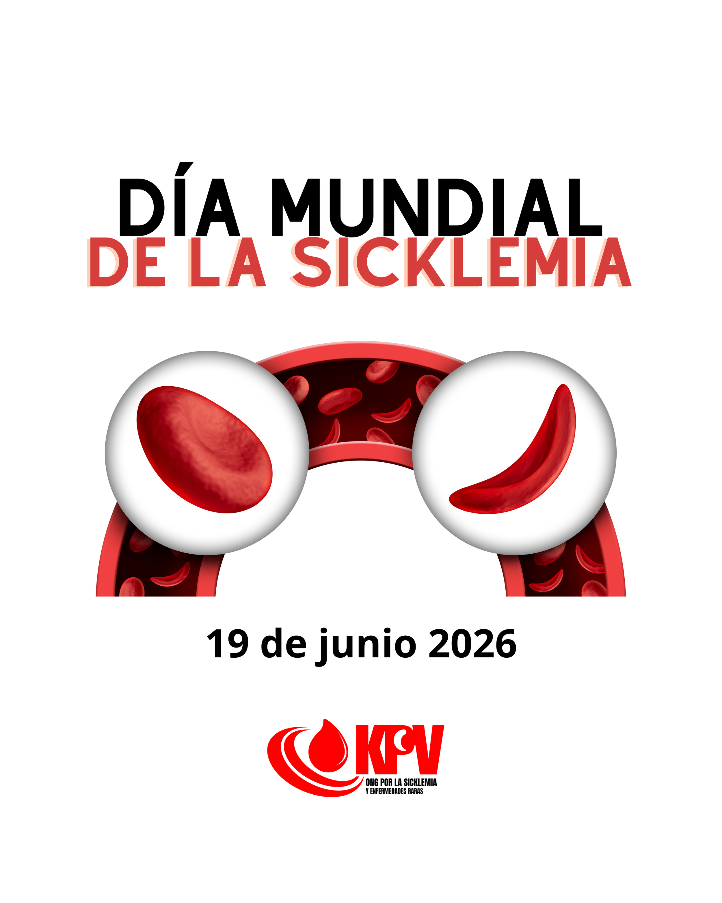 Dia mundial de la sicklemia (anemia falciforme)
