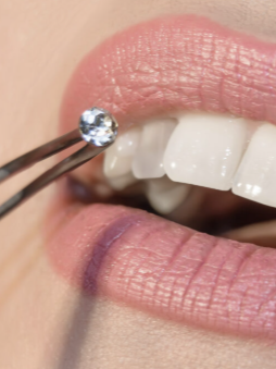 Close-up of a person’s teeth and lips, with a dental tool placing a diamond or gemstone on the front tooth.