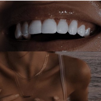 Close-up of a smiling person showing their teeth, with part of their neck and shoulder visible.