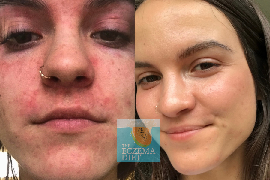 Before and After- Websie copy 2.png