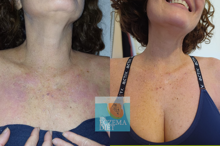 Before and After- Websie (1).png