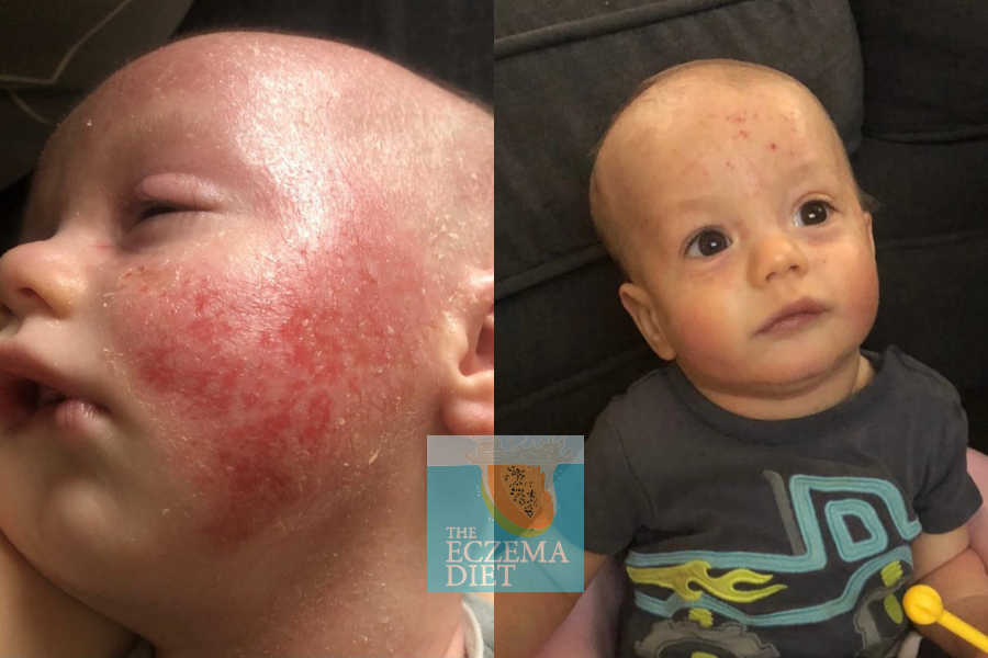 Before and After- Websie (1) copy 2.png