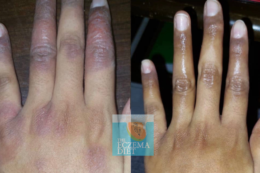 Before and After- Websie (1) copy.png