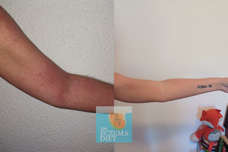 Before and After- Websie.png