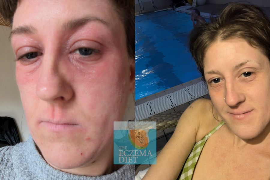 Before and After- Websie.png