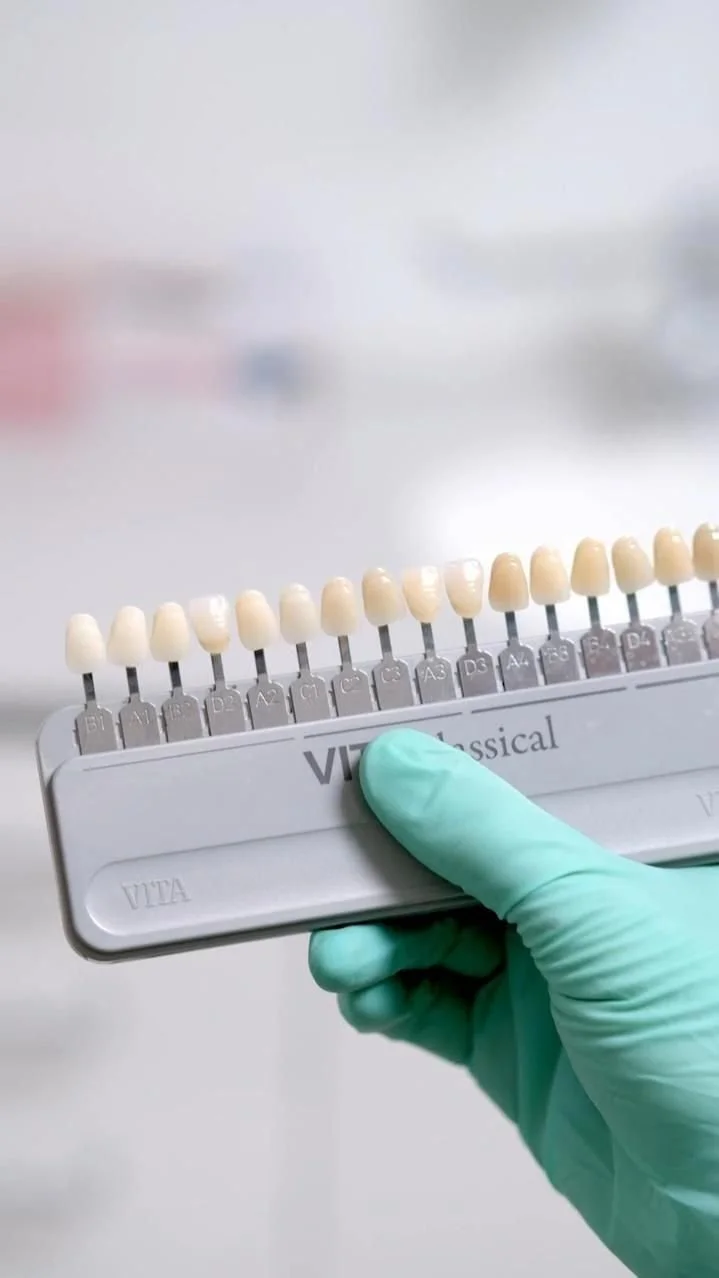 Mostrador de cores de dentes de prótese dental ou material coronal, sendo manuseado por uma pessoa com luva rubber, em ambiente de clínica odontológica.