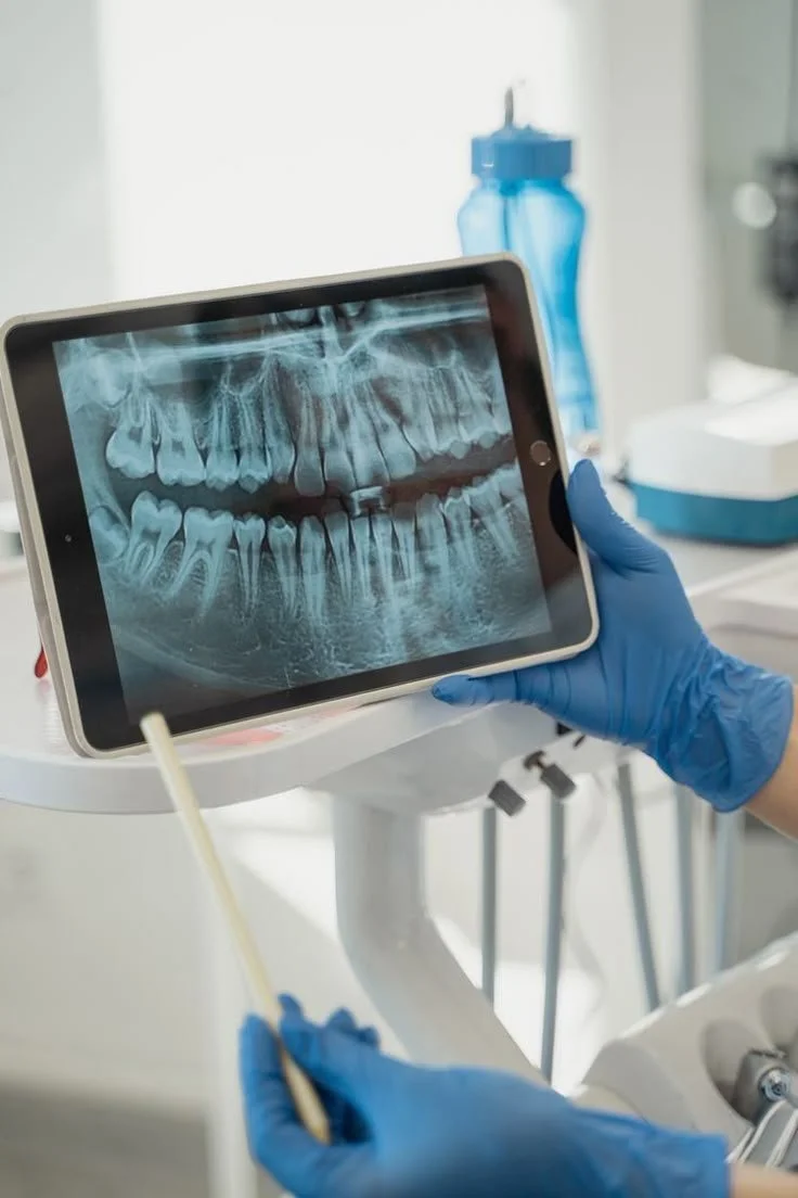 Raio-X de dentes exibido em um tablet sendo manuseado por uma pessoa com luvas azuis em um consultório odontológico.