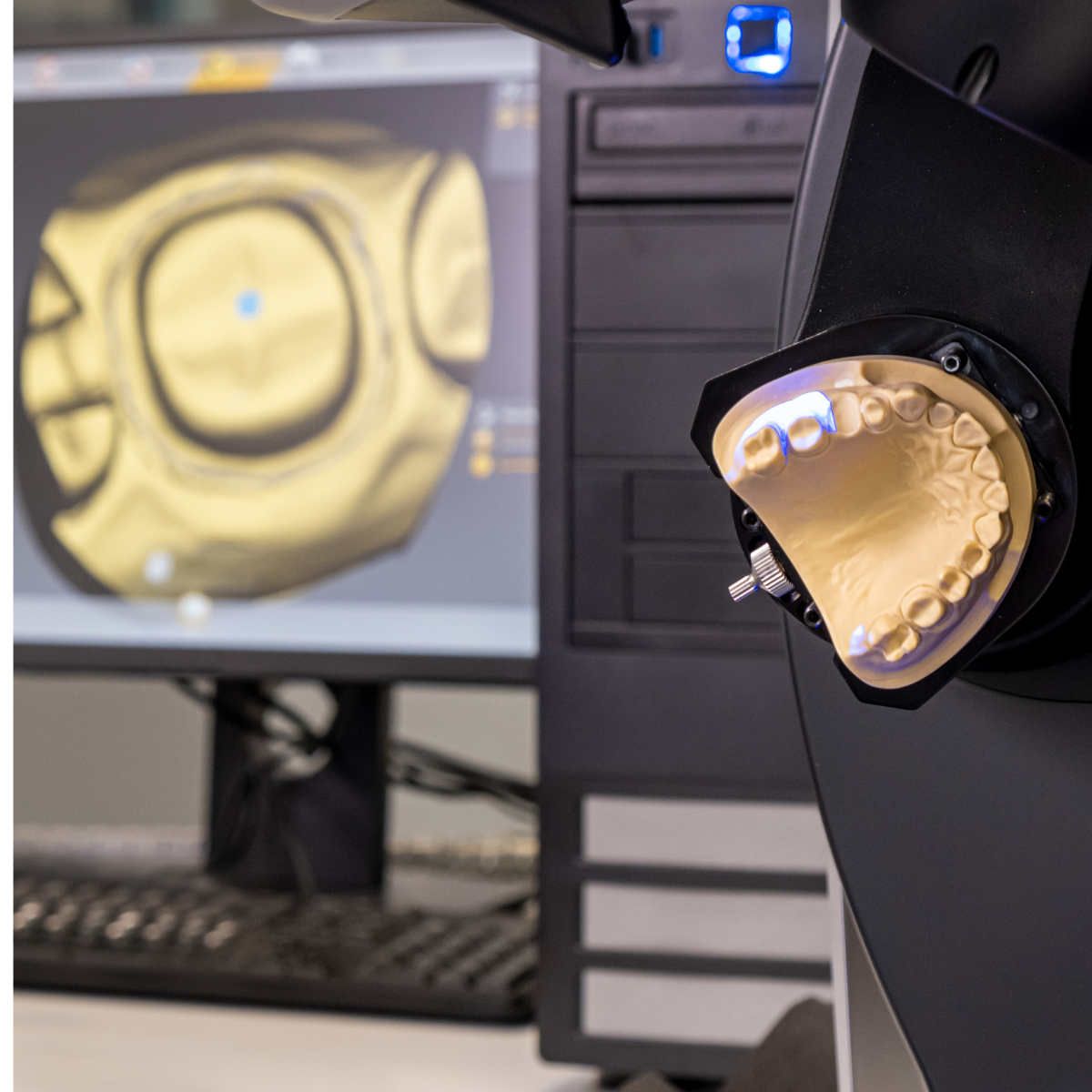 CAD/CAM Service for Labs