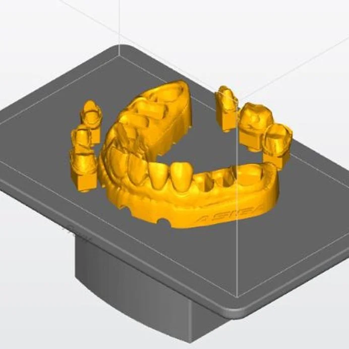 Digital 3D rendering of a dental model in yellow, held on a gray platform for 3D printing or scanning.