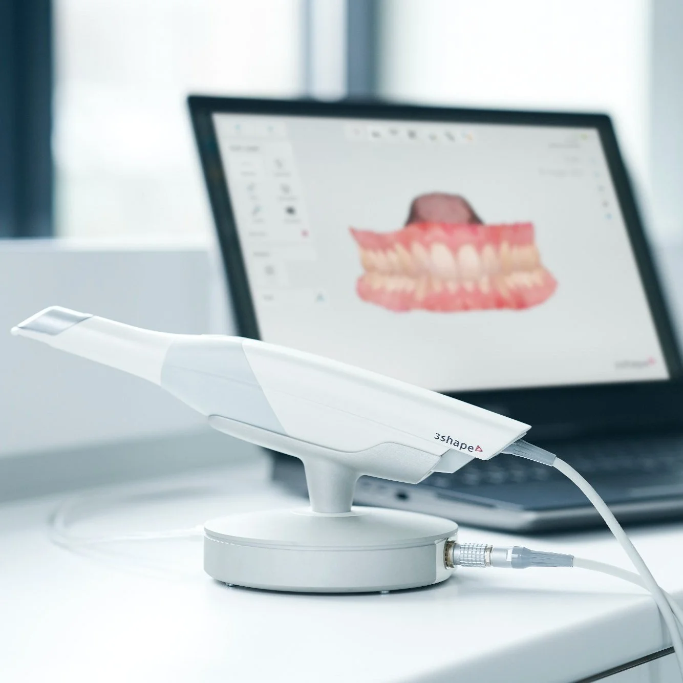 A digital dental scanner connected to a computer displaying a 3D scan of a teeth and gums model.