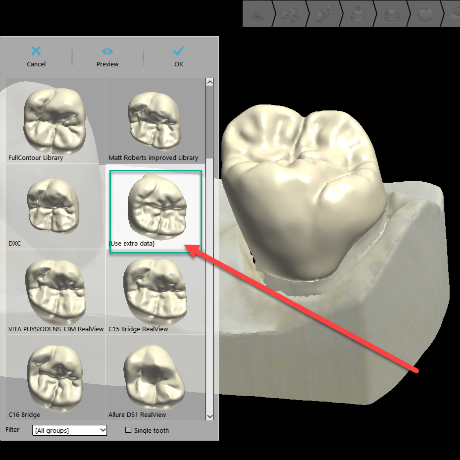 Digital dental impression of a molar tooth with a selection of 3D models of different molar designs displayed on a computer screen.
