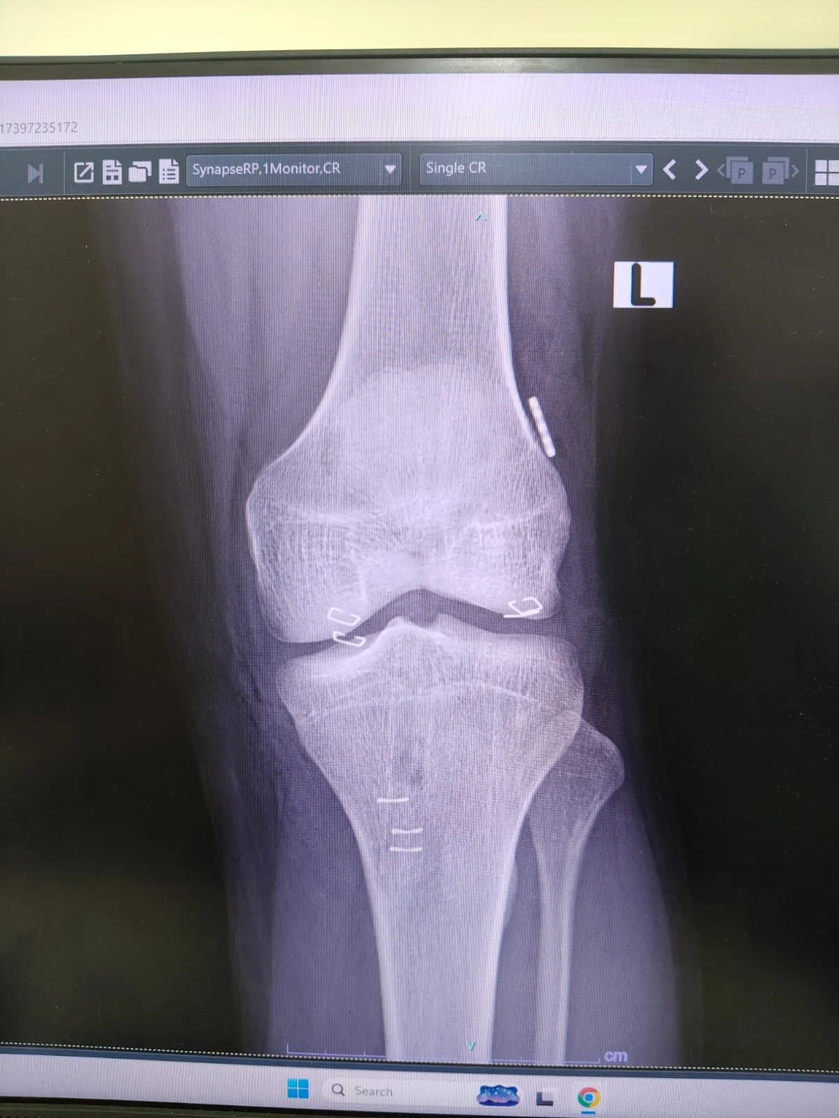 Arthroscopy & Sports Injuries