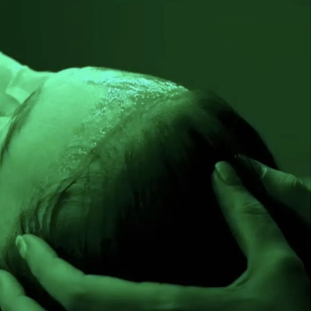 The Benefits of LED Therapy After Aesthetic Medical Treatments