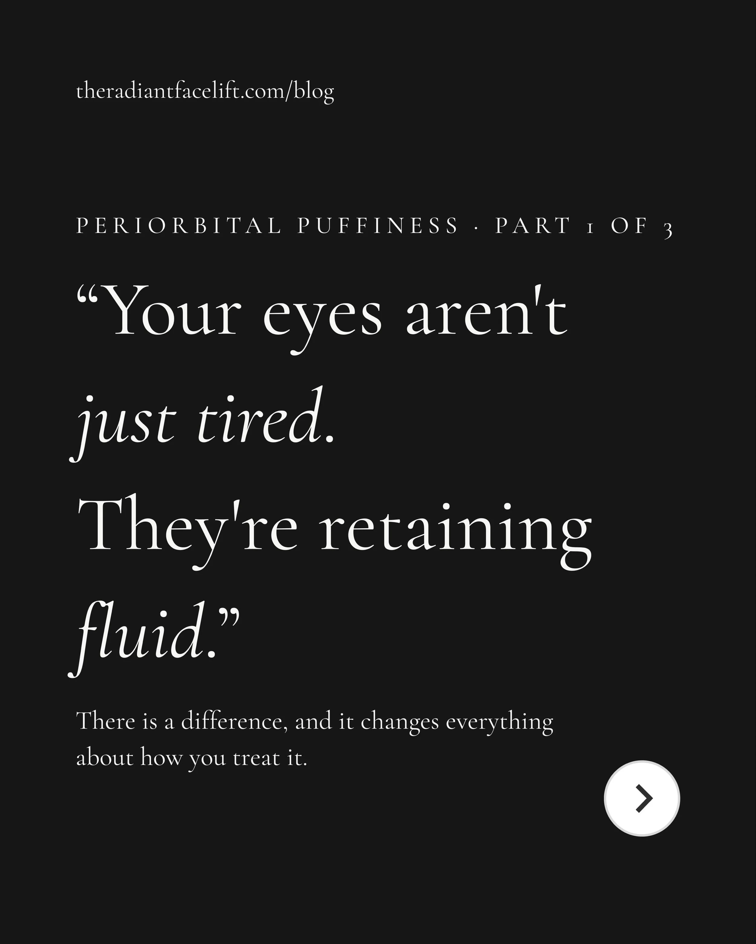 🇬🇧 Why are your eyes puffy every morning, even when you slept well?
It has nothing to do with tiredness. It&rsquo;s interstitial fluid accumulating in the loosest, thinnest connective tissue on the entire face: 0.5 mm of skin, no subcutaneous fat a