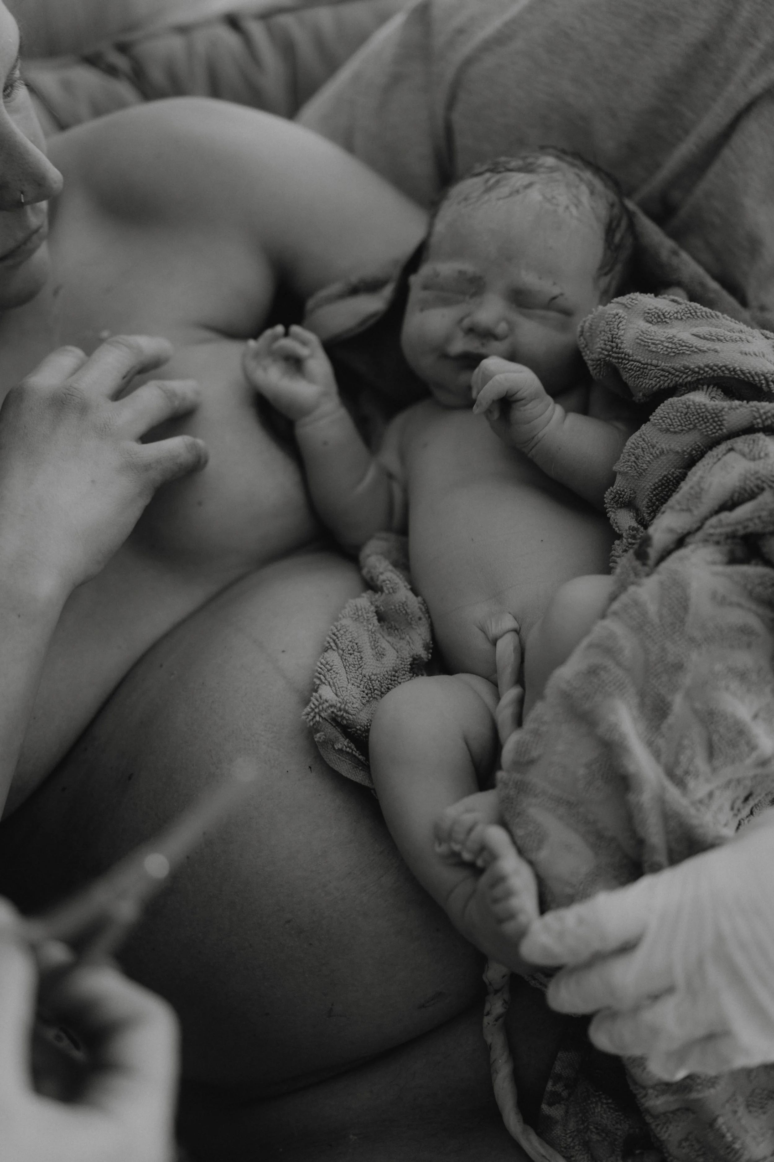 Ein neugeborenes Baby liegt auf der Brust einer Frau, vermutlich die Mutter, während es medizinisch versorgt wird. Das Baby ist nackt und trägt eine Kabelgebundene Nabelschnur, die noch angeschlossen ist. Es ist eingehüllt in Handtücher und ist im Kr