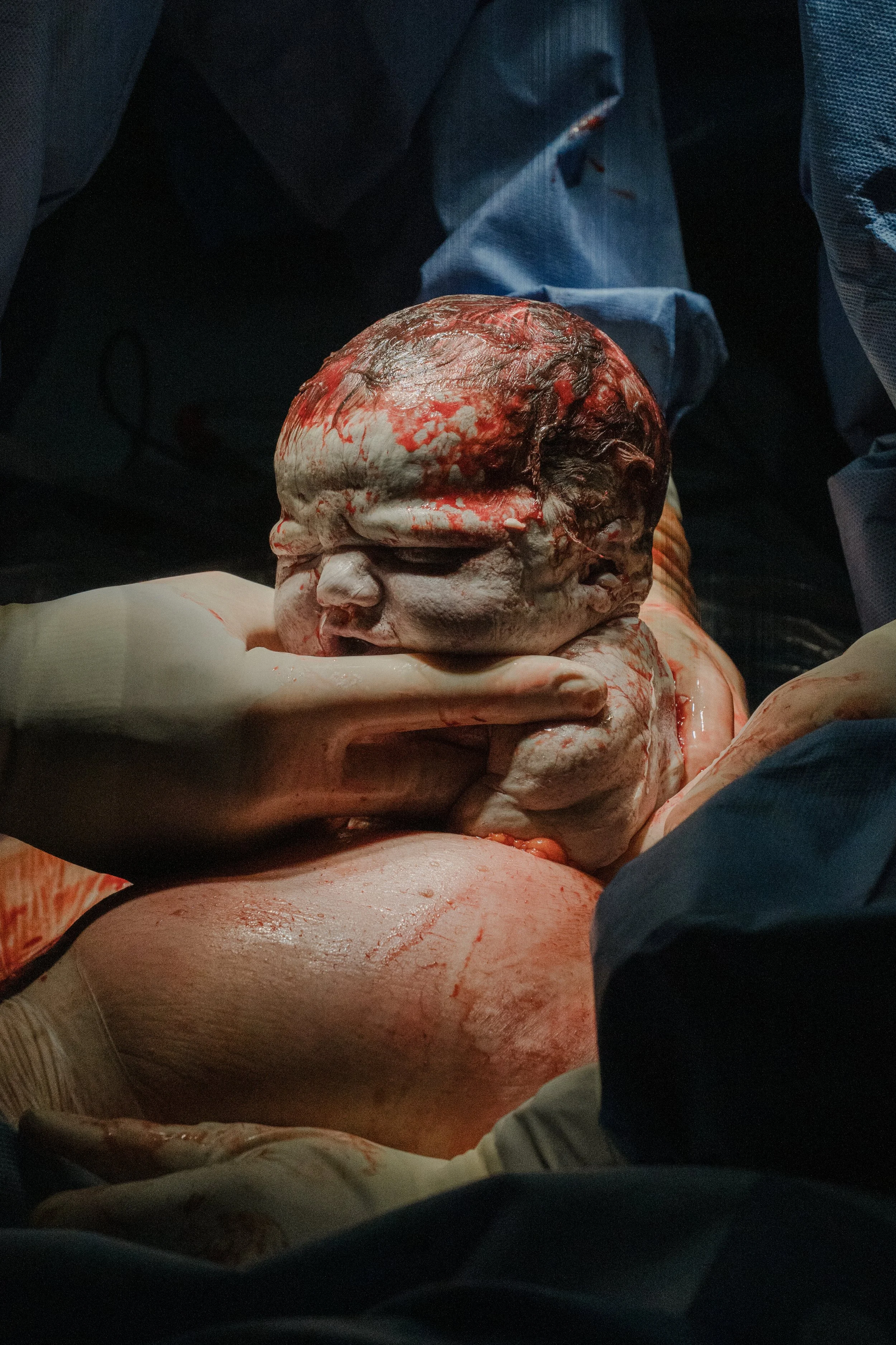 Ein Säugling wird bei der Geburt im Krankenhaus von Medizinern betreut.