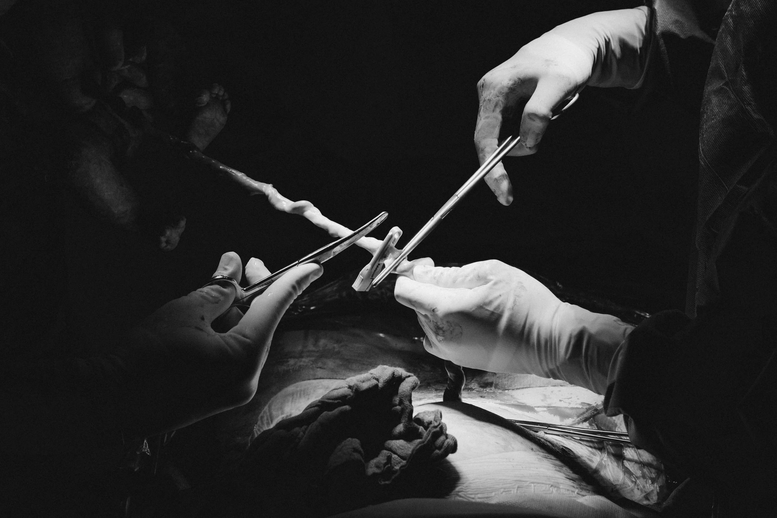 Ärzte oder Chirurgen bei einer Operation, die sterile Handschuhe tragen und medizinisches Instrumentarium verwenden.