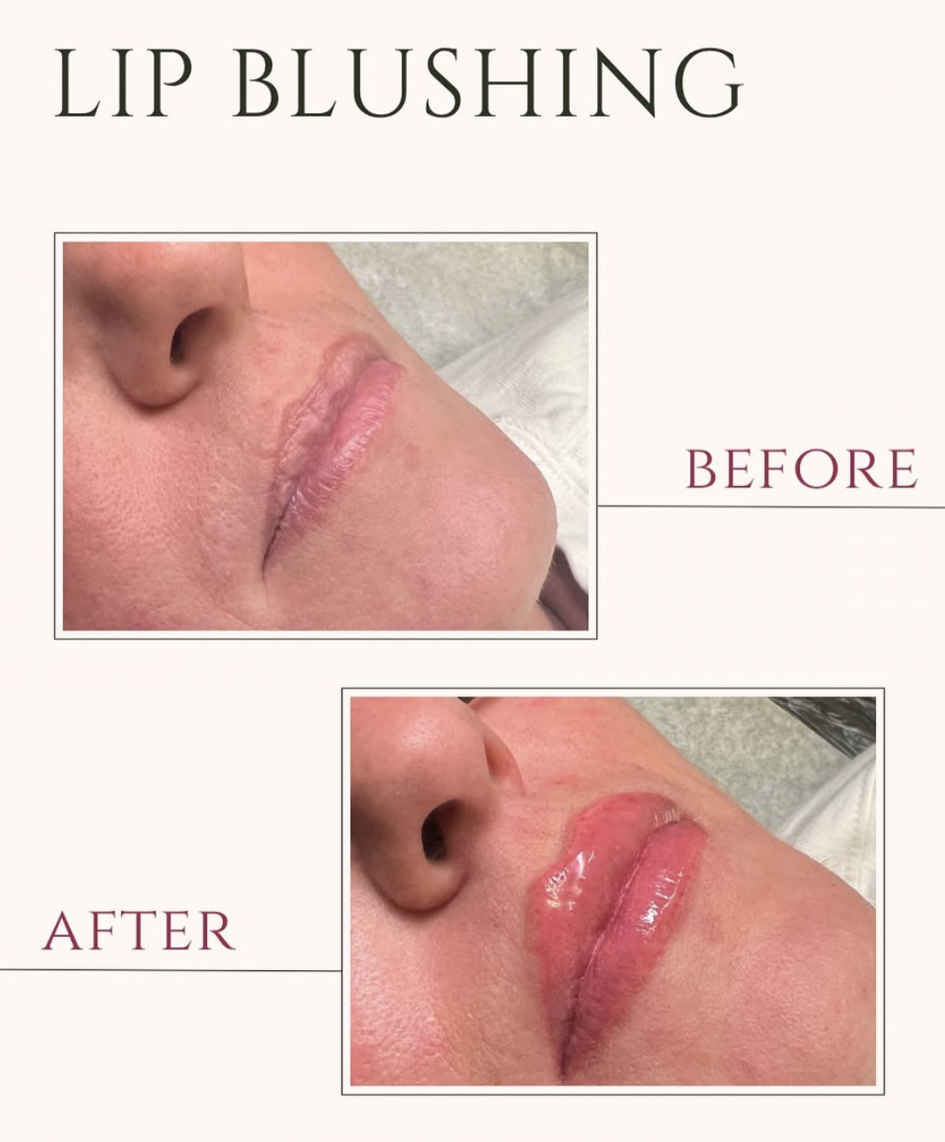What to Expect Before and After Permanent Makeup in Latham, NY