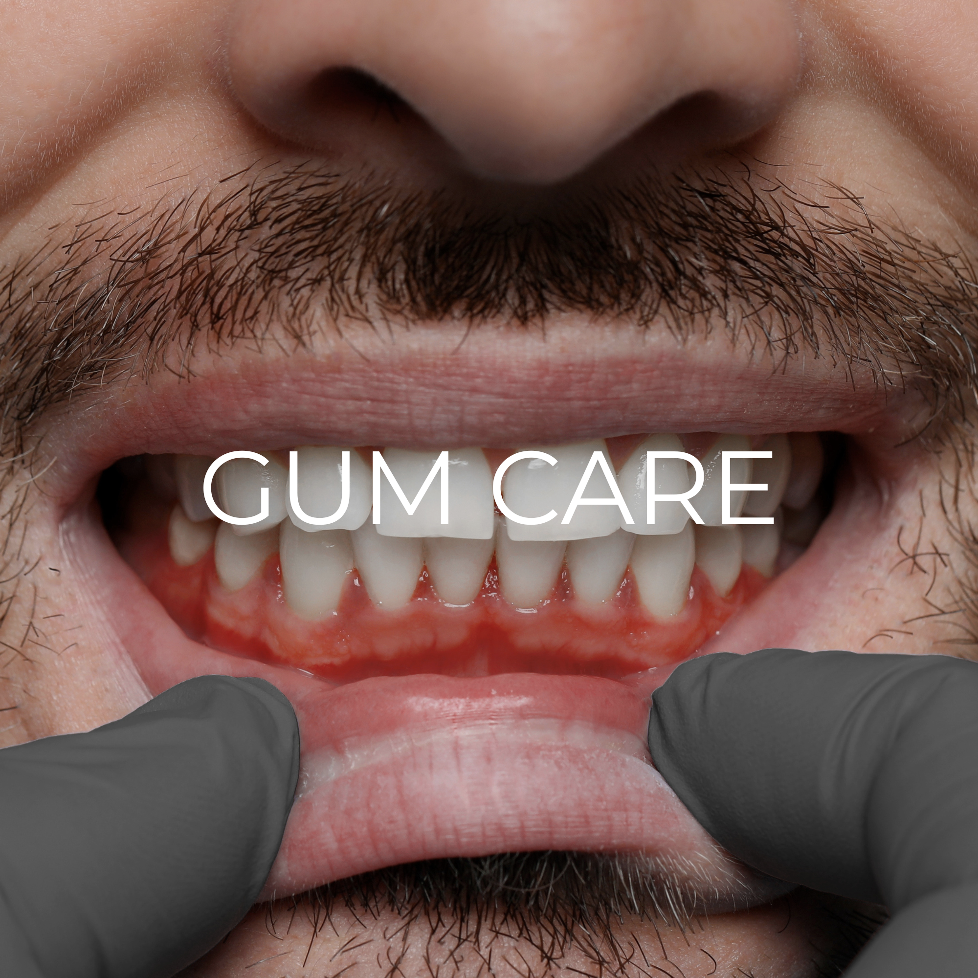 Functional Oral Care - Gum Care - Premium Oral Care Manufacturer