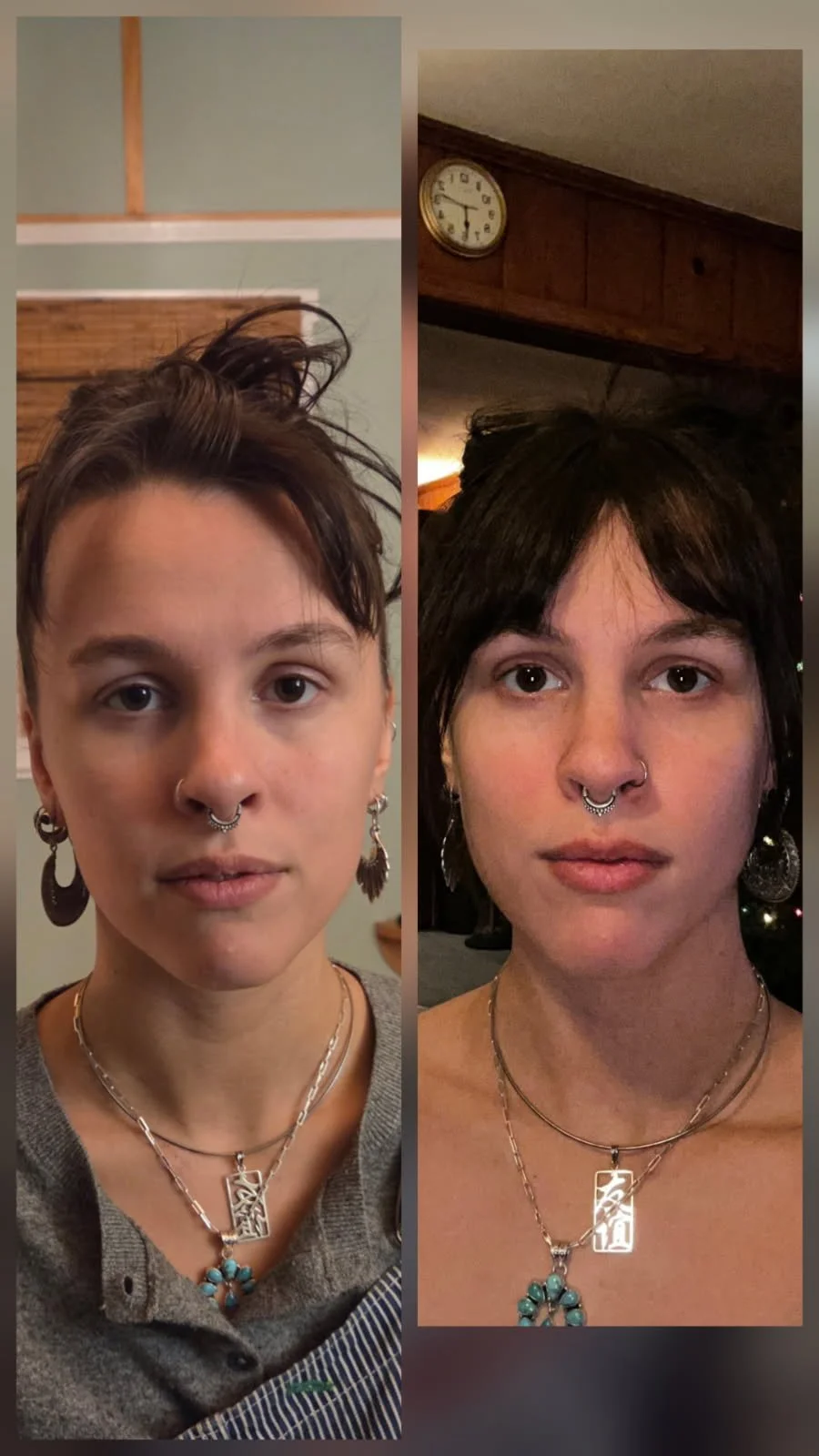 Before and After of Facial Massage