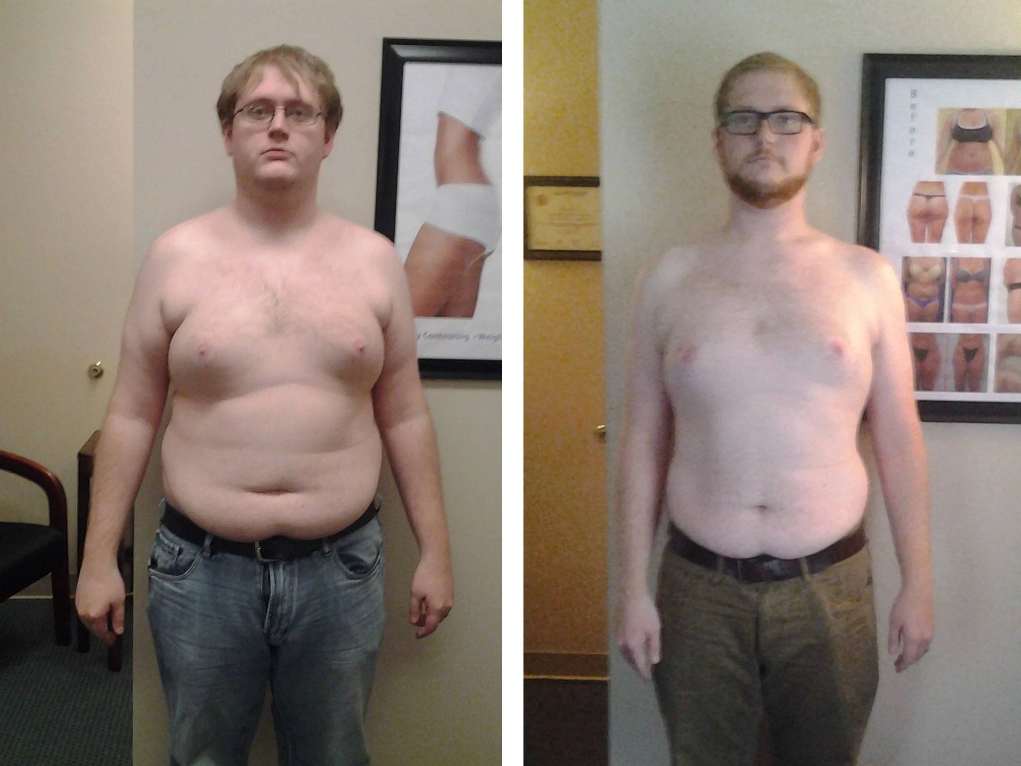 Before and after.jpg