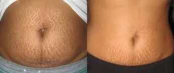 stomach.jpg