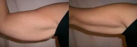 arm transformation2.jpg