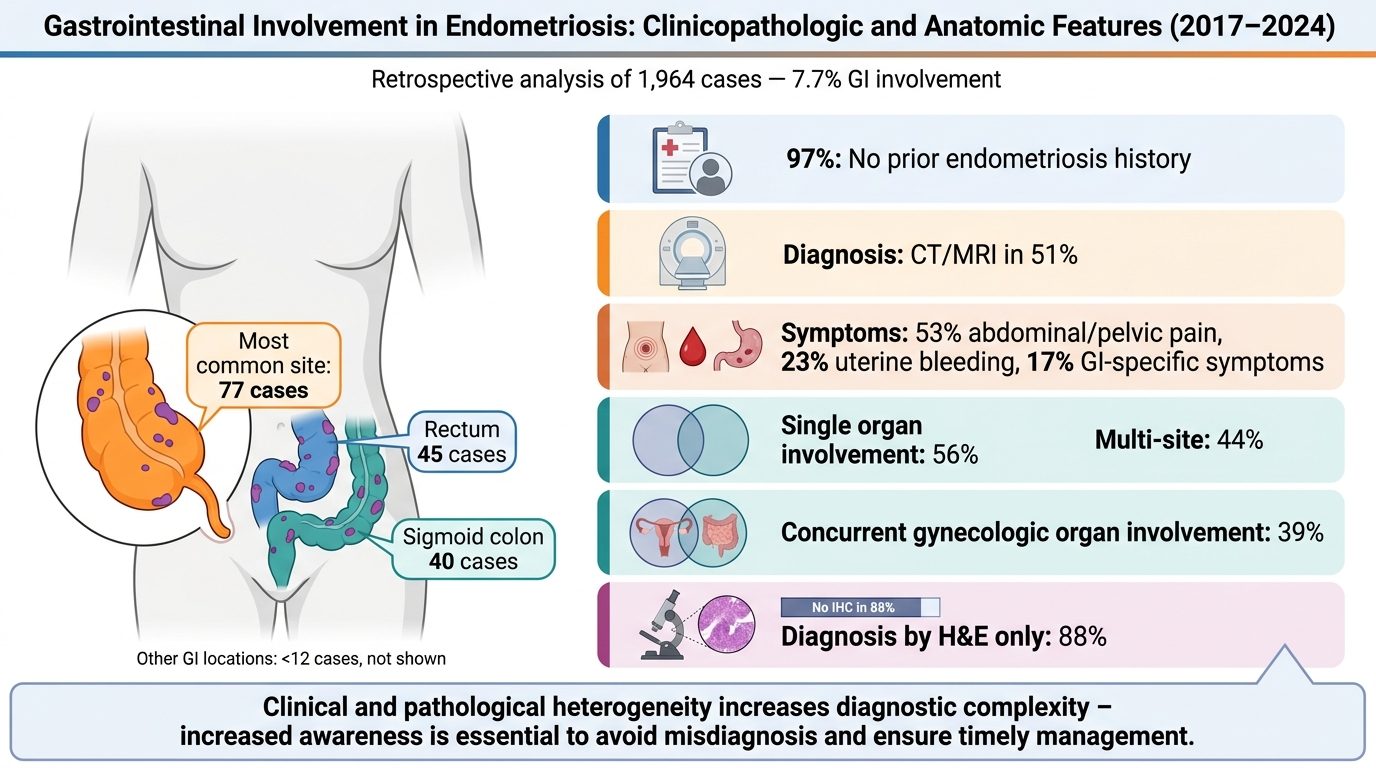 A medical infographic about gastrointestinal involvement in endometriosis, including statistics on site frequency, symptoms, and diagnosis methods, with a diagram of the female pelvic area highlighting common sites like the rectum and sigmoid colon.