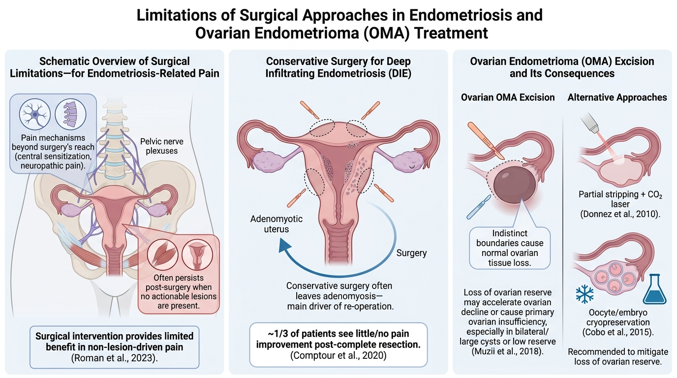 A scientific infographic titled 'Limitations of Surgical Approaches in Endometriosis and Ovarian Endometrioma (OMA) Treatment.' It is divided into three sections. The first shows a diagram of the pelvis with pain mechanisms, nerve plexuses, and post-